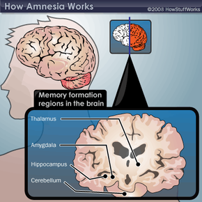 The Process of Memory From Perception to Retrieval - How Amnesia Works