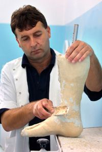 A prosthetist uses body measurements to construct a prosthetic limb that will fit the patient properly.