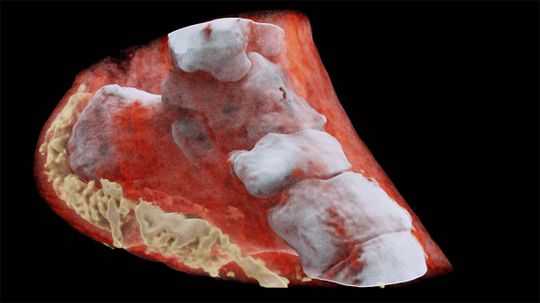 科学家研制出世界上第一张彩色3D x射线＂border=