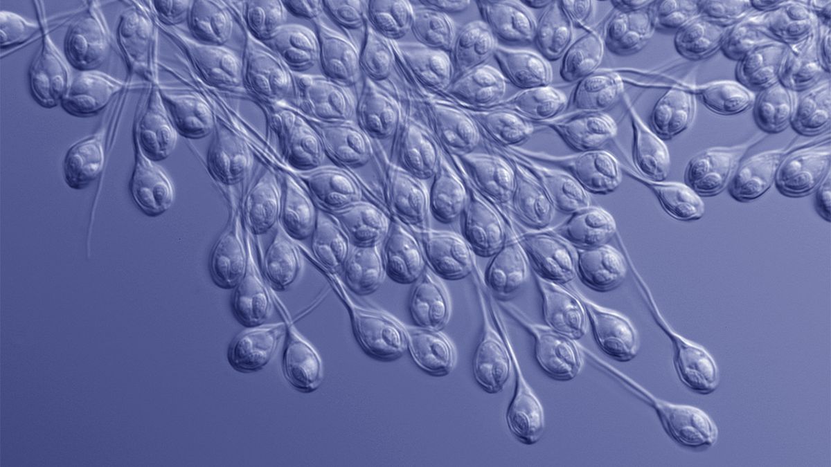 Can You Live Without Oxygen? This Animal Can HowStuffWorks