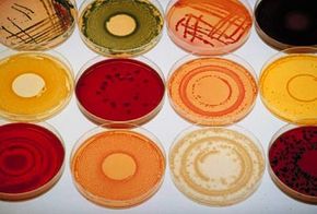 A variety of bacteria grow in a lab at pharmaceutical company Aventis Pasteur.