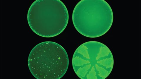 Artificial Intelligence Discovers Antibiotic in Record Time - Vimarsana News