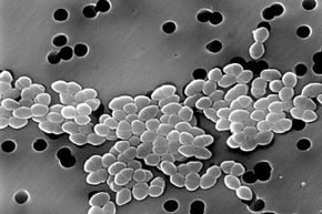 Vancomycin-resistant Enterococci, a bacteria that's adapted over time to the point that antibiotics are not as effective in fighting it.
