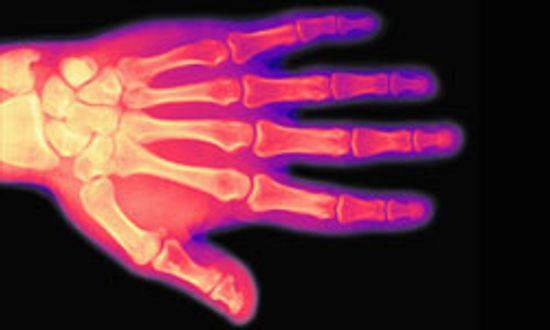 癌症和骨痛＂class=