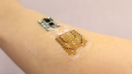 Smart Bandages Can Monitor, Treat Chronic Wounds