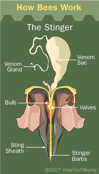 How Bee Sting Therapy Works | HowStuffWorks