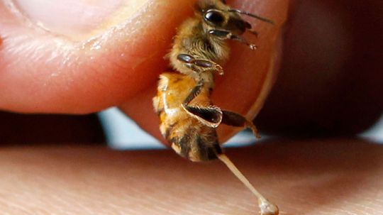 How Bee Sting Therapy Works