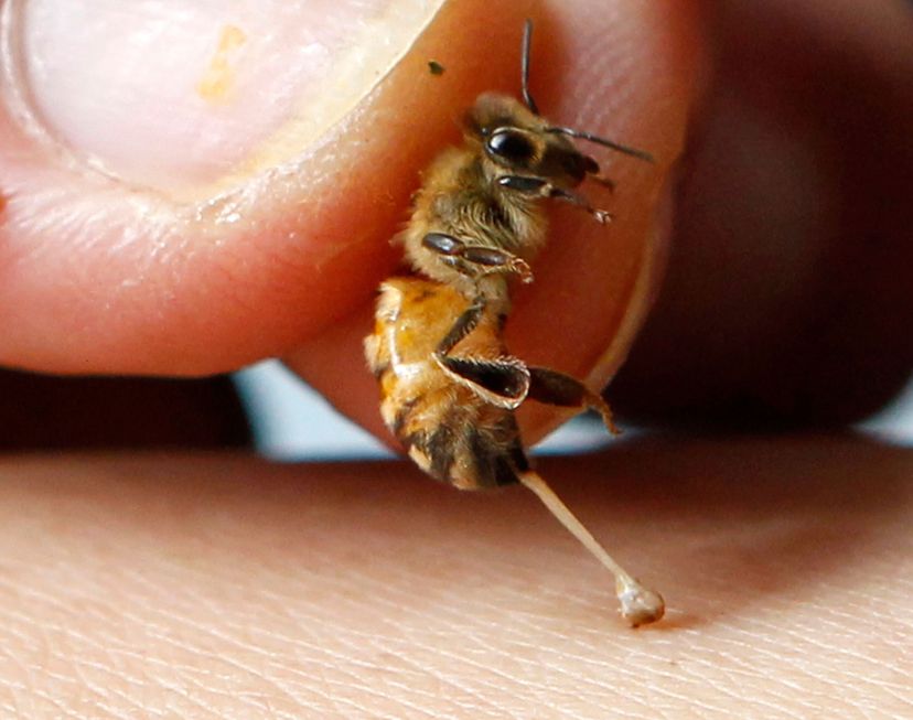 How Bee Sting Therapy Works | HowStuffWorks