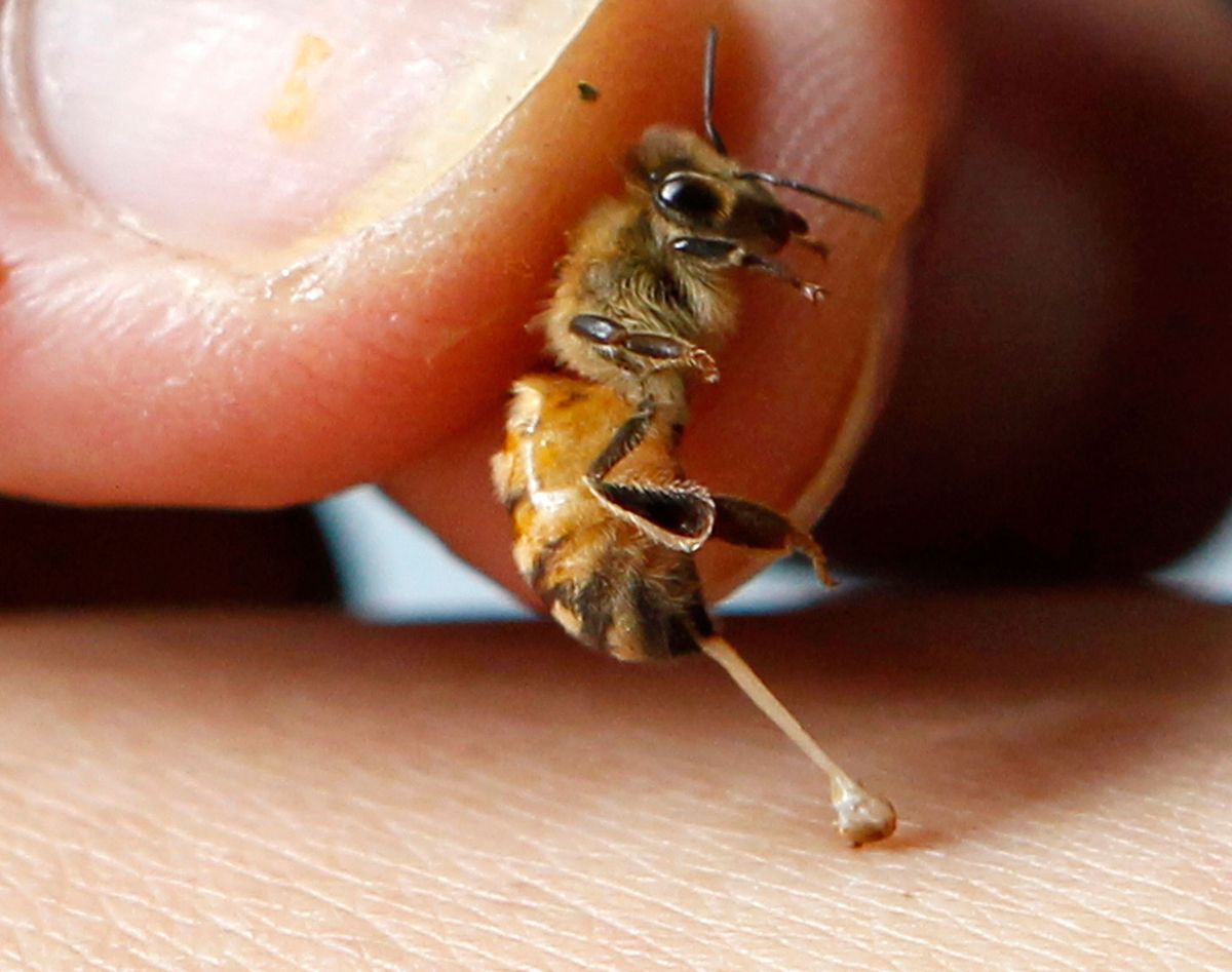 How a Bee Sting Can Trigger a Deadly Heart Attack.