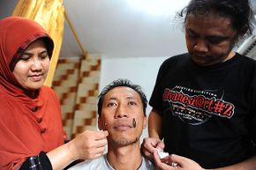 Leech therapists Sri Oentarti (L) and Asep Nugraha (R) treat a patients with leeches at their clinic on April 15, 2014 in Surabaya, Indonesia. Leeches are a very old medical treatment that is making a comeback.