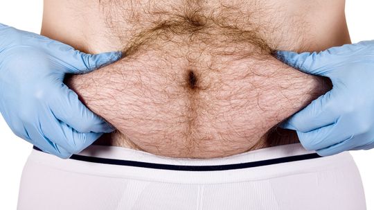 Is what's in my belly button really lint?