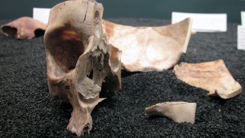 The Mysterious Skeletons in Ben Franklin's Basement - Vimarsana News