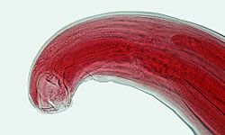 Some people claim that the hookworm (seen here) has the ability to cure everything from allergies to asthma.