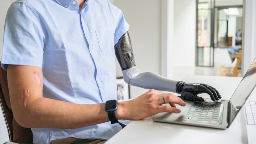 A man with bionic arm working on a laptop in his office