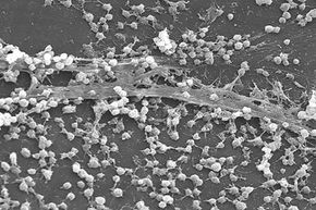 Biofilm formation that occurs in an indwelling catheter, such as this one show on an electron micrograph, may lead to staph infections.