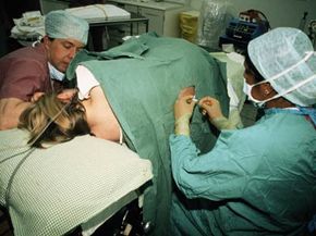 An anesthesiologist administers an epidural.