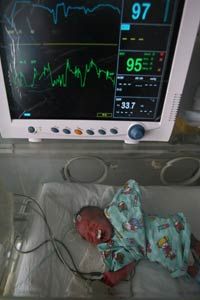 A premature baby undergoes treatment at Xining Children Hospital in China.