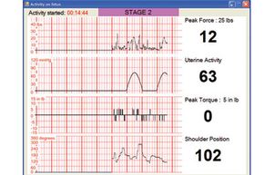 出生模拟器读出生命体征”width=