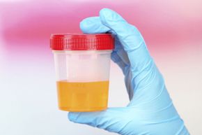 There is no evidence that drinking urine or applying it to injuries is beneficial. 