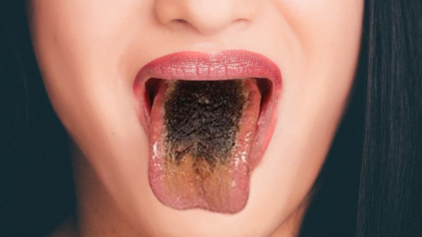 black tongue	