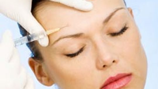 Botox: Fast Facts