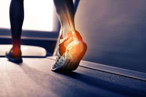 足底筋膜炎是脚后跟疼痛的常见原因。一项研究表明，肉毒杆菌可以帮助治疗这种疾病。＂border=