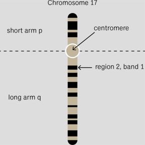 BRCA1基因所在的17号染色体可能是什么样的。＂border=