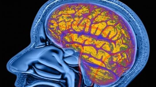 Top 10 Myths About the Brain