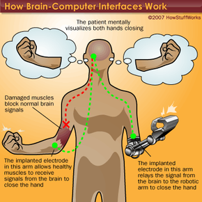 An illustration, explaining how a brain-computer interface works.