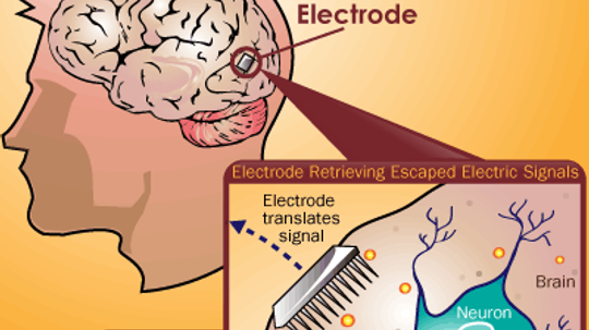 How Brain-computer Interfaces Work