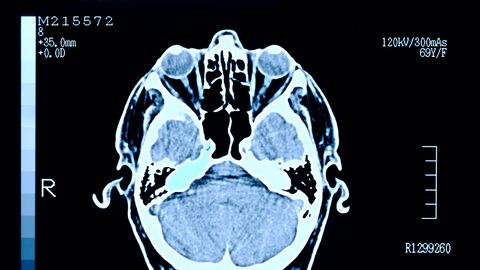 Our Brains Have 'Fingerprints' — And We Can Find Them Fast - Vimarsana News