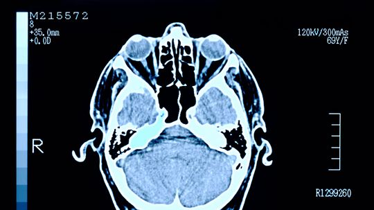 Our Brains Have 'Fingerprints' — And We Can Find Them Fast