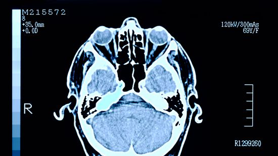 Our Brains Have 'Fingerprints' — And We Can Find Them Fast