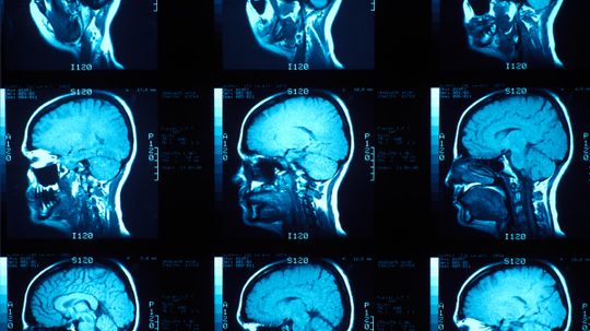 Could a brain scan tell you if you're going to become a criminal?