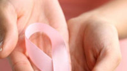 Breast Cancer: An Overview with Basic Terms