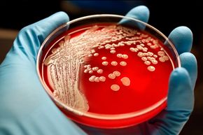Methicillin-resistant Staphylococcus aureus (MRSA) is a type of staph infection that’s resistant to many antibiotics.