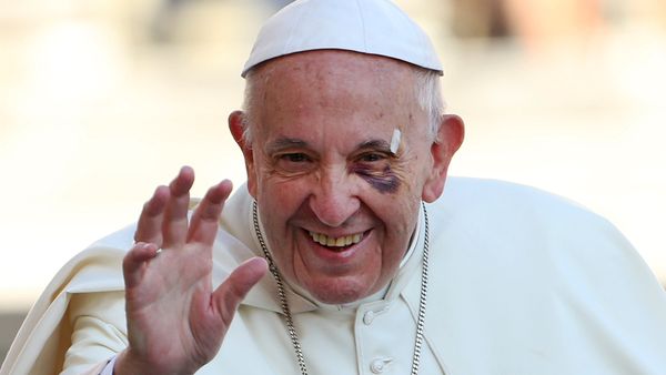 Pope with black eye