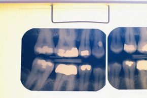 Dental x-ray. 