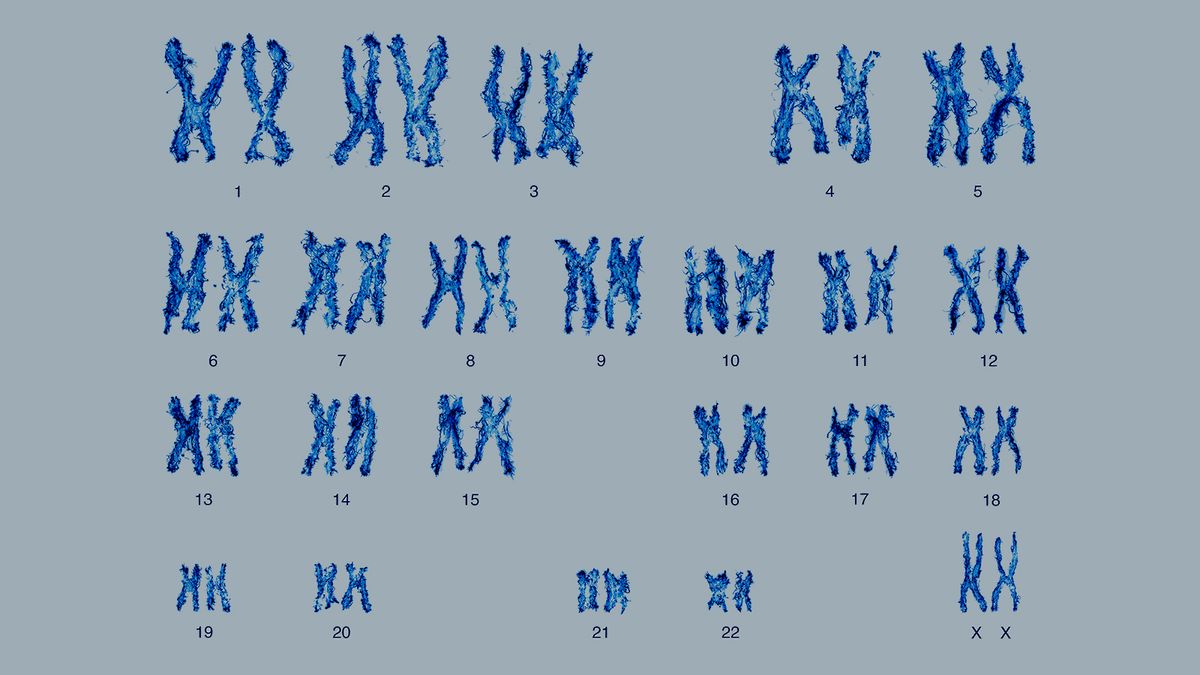 x and y chromosomes chart