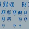 为什么大多数人有23对吗Chromosomes?
