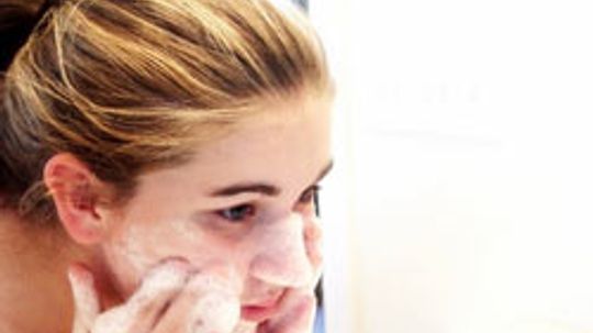Top 5 Tips for Cleansing Acne-prone Skin