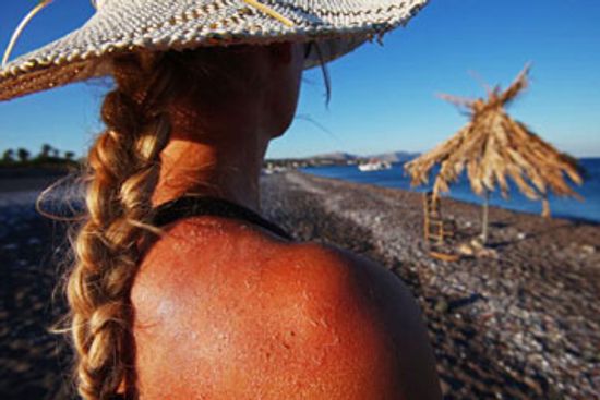 How to Cleanse When You Have a Sunburn