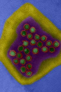 This color-enhanced scan shows the herpes simplex virus.