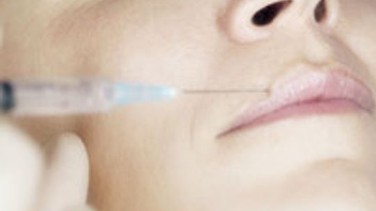 Collagen Injections Overview