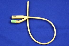 A pediatric Foley catheter sits on a table. Doctors can blow up a balloon at the non-forked end of the catheter after it's inserted in the bladder to hold it in place.