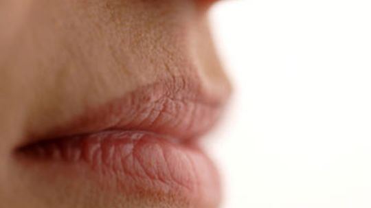 Can cracked lips be a sign of dehydration?