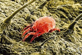 Dust mites are eight-legged creatures that don't bite or cause illness -- and just as you might guess, live in dust particles.