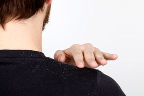 Man brushing off dandruff.