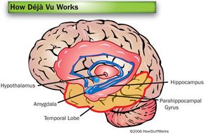 What Causes Déjà Vu?