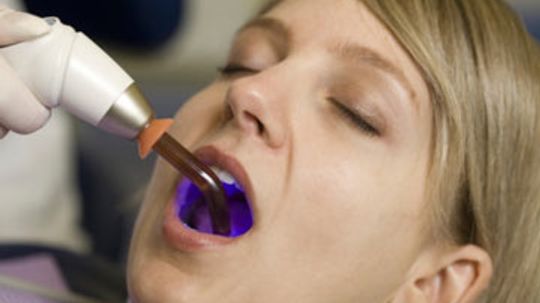 Can dental work cause an upset stomach?